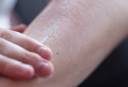 A thin layer of Charity Pot, a cream coloured body lotion, is rubbed into an arm.